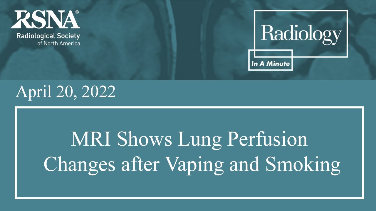MRI Shows Lung Perfusion Changes after Vaping and Smoking - YouTube
