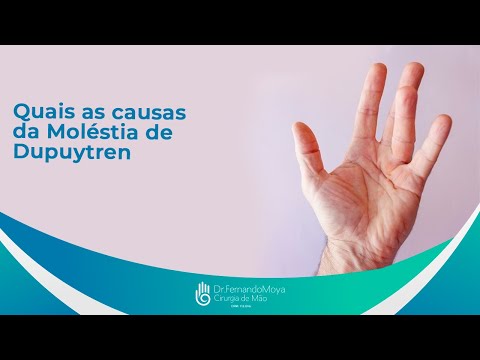 Quais as causas da Moléstia de Dupuytren? | Dr. Fernando Moya CRM 112046