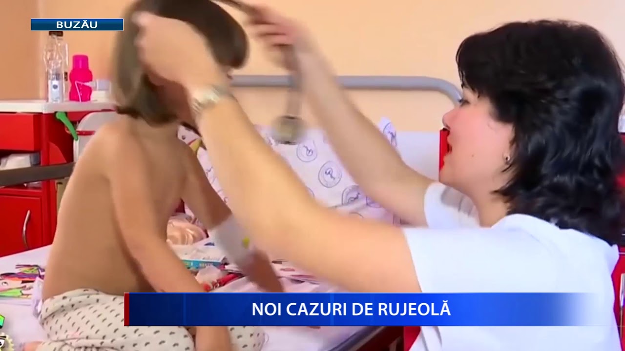 camera iphone 8 plus apk NOI CAZURI DE RUJEOLA