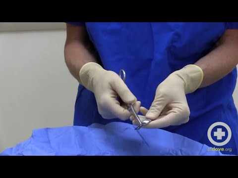 Video: Bola odstránená sangvinická čepeľ?