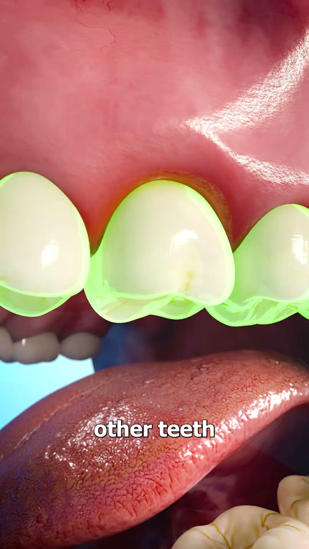 How Dentists Reinsert A Tooth ?