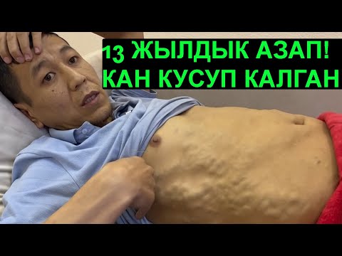 Video: Оору менен азап бирдейби?