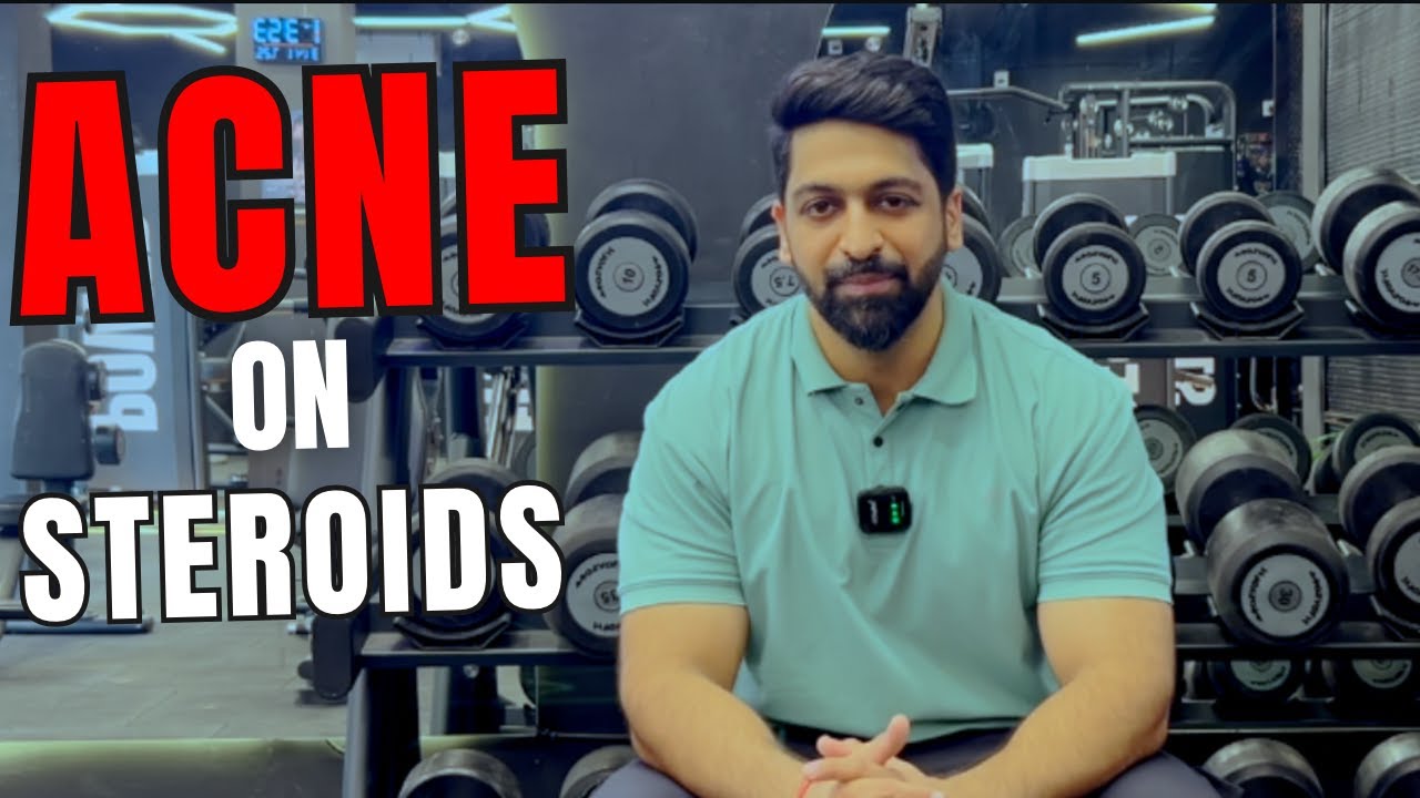 The SHOCKING Truth About Acne on Steroids EXPOSED - YouTube