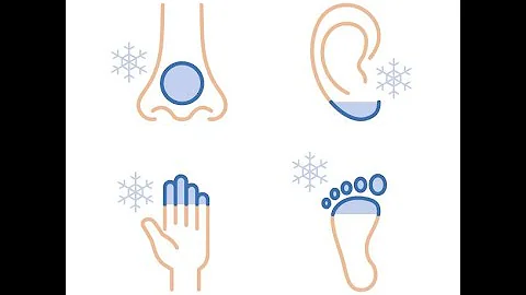 The 4 Stages of Frostbite