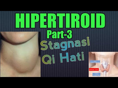 HIPERTIROID (Part-3)Sindrom Stagnasi Qi Hati *Eps-37