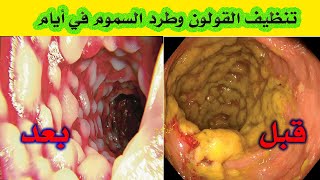 تنظيف القولون من البراز المتراكم والسموم وتنظيف البطن والأمعاء والمعدة من الغازات نهائيا