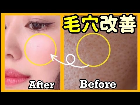 毛穴の開き治る たるみ毛穴のケア方法 Youtube