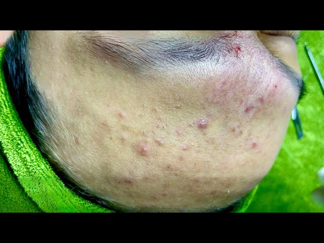 Satisfying video with Chung Vo Spa | 218