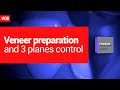 Veneer preparation and 3 planes control. 1 dental minute