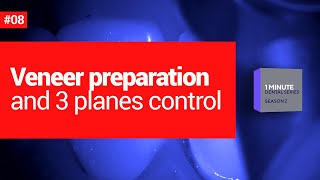 Veneer preparation and 3 planes control. 1 dental minute