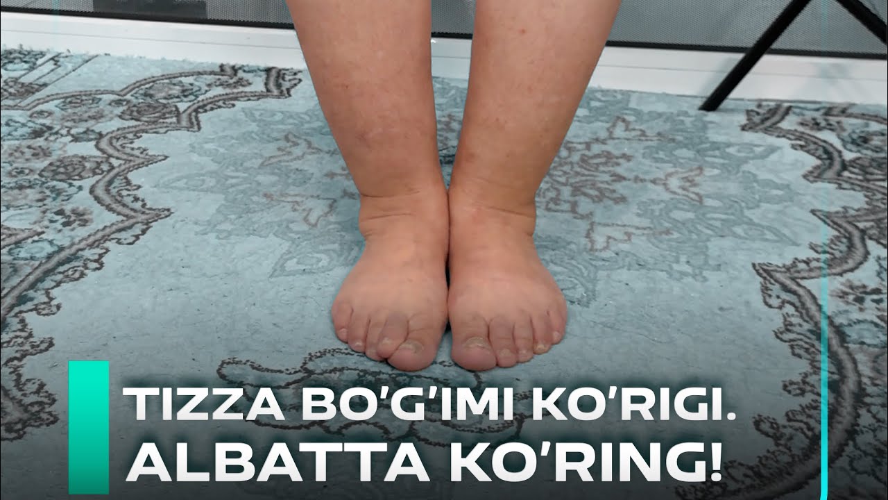 Tizzangiz og‘riyaptimi? Albatta ko‘ring!