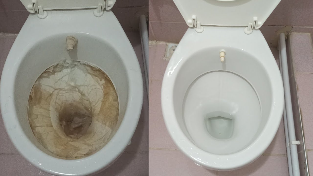 Çok Az Kişi Klozetteki Sarı Lekeler Nasıl Çıkar Bilir ! | Klozet Temizliği Nasıl Yapılır ?