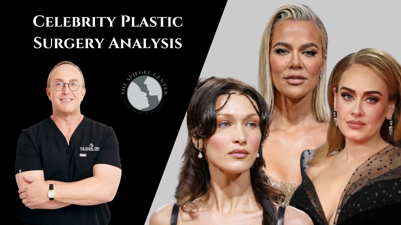 These Celebs Were Accused of Getting Buccal Fat Removal Bella Hadid, Adele & Khloe Kardashian