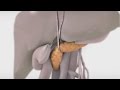 Pancreaticoduodenectomy or whipple procedure trailer  tvasurgca