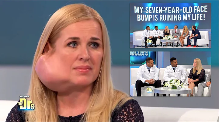 Parotidectomy for Large Facial Tumor Removal on The Doctors TV Show - DayDayNews