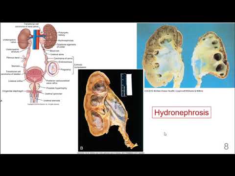 Renal and Urologic Disorders