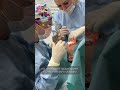 Чем отличается мужская блефаропластика от женской?