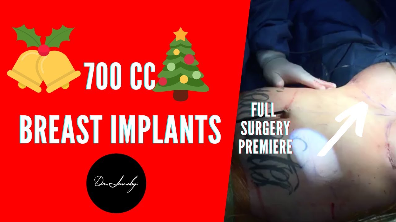 Breast Augmentation With 700cc Silicone Implants Dr Jeneby 2020 First breast-augmentation-with-700cc-silicone-implants-dr-jeneby-2020-first