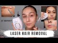 I DID AT HOME LAZER HAIR REMOVAL!!