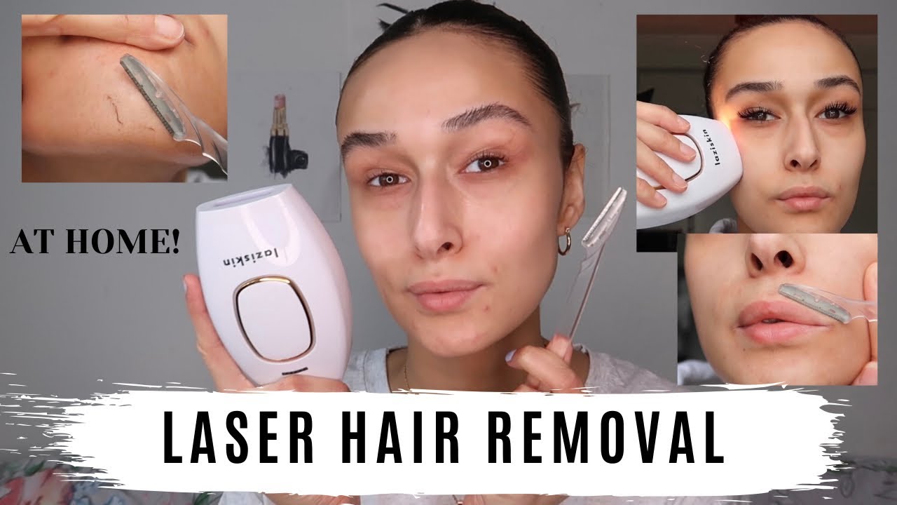 5minskin Hair Removal Reviews: A Comprehensive Analysis - video Dailymotion