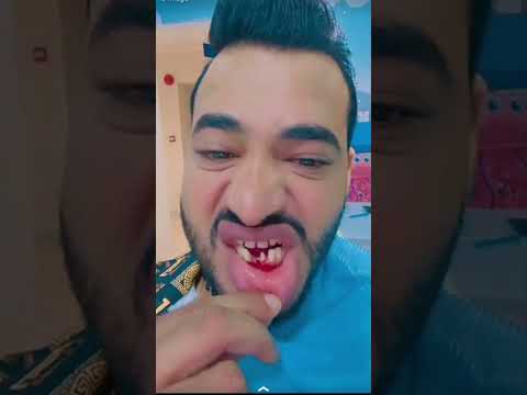كوتش ايمون في عياده اسنان