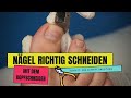 Zehennägel richtig schneiden mit dem Kopfschneider - so geht es!