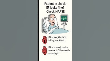 Vertrouw de ejectiefractie niet op de IC!!!