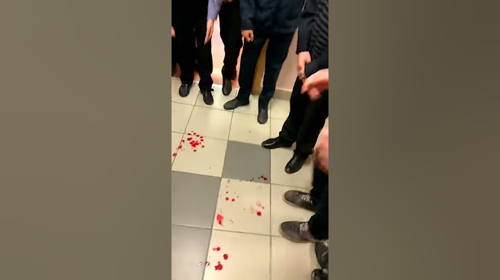 Разбили нос в школе!!!шок везде кровь