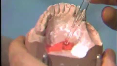 Selecting and Preserving the Path of Insertion and Removal