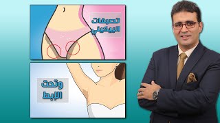 تفتيح الأماكن الحساسة في أسبوعين