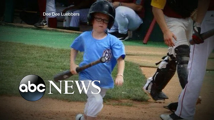 Bat Boy, 9-Years-Old, Killed by Bat