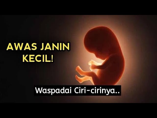 Awas Ukuran Janin Kecil! Ini Ciri-ciri dan Penyebabnya.. class=