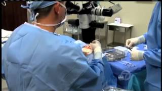 Optimedica Catalys System