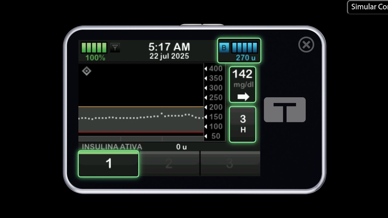 Funcionamento Básico da Bomba de Insulina Tandem T:Slim X2 com tecnologia Control-IQ
