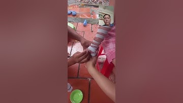 Xử lý rắn lục đuôi đỏ cắn cho 1 cháu nhỏ trong bình dương 