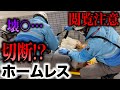 【閲覧注意】破裂寸前の足を引きづるホームレスの男性に救急隊が出動する事態に・・・
