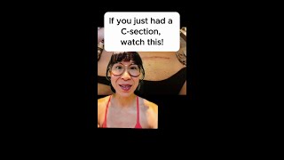 If you just had a C-section, watch this!