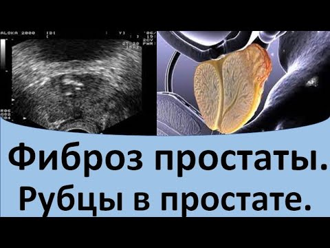 Видео: Вратите от фибростъкло ли са?