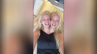Conjoined Twins Living Their Best Life ❤️ | Beautiful Sister Bond