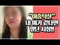 이중턱지방흡입 전 이건 꼭! 반드시!! l 이중턱처짐 l 바이오본드 l 압구정성형외과