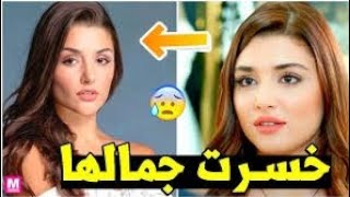 هاندا ارتشيل بين الماضي والحاضر تغير كبير في الملامح و السبب ?