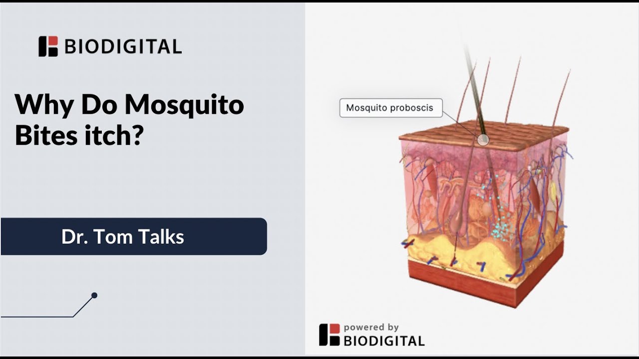 Why Do Mosquito Bites Itch Dr Tom Talks Youtube