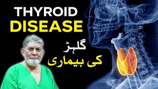 Goitre: Thyroid diseases: گلہڑ کیا ہے؟