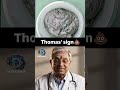 Thomas' sign | Best app for NEET PG Preparation | Dopamine |