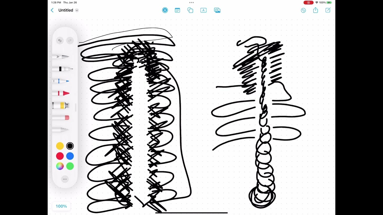 iPad Pro 12.9 3rd Gen, Apple Pencil 2nd Gen skipping Problem