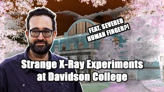Unusual Xray History at Davidson College (Bullets, Bribery, & A Human Finger!)