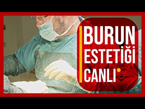 Video: Estetik Ameliyattan önce Bile: Yana Koshkina Kancalı Burnu Ve Gri Saç Telleriyle Kendini Gösterdi