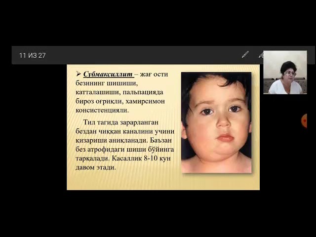 Марина Алиеваның порносын көріңіз Жалаңаш модель Карли Клосс