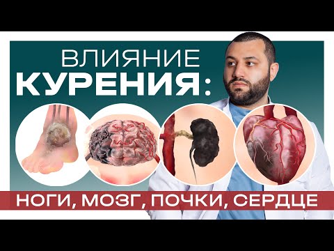 ВЛИЯНИЕ КУРЕНИЯ: НОГИ, МОЗГ, ПОЧКИ, СЕРДЦЕ