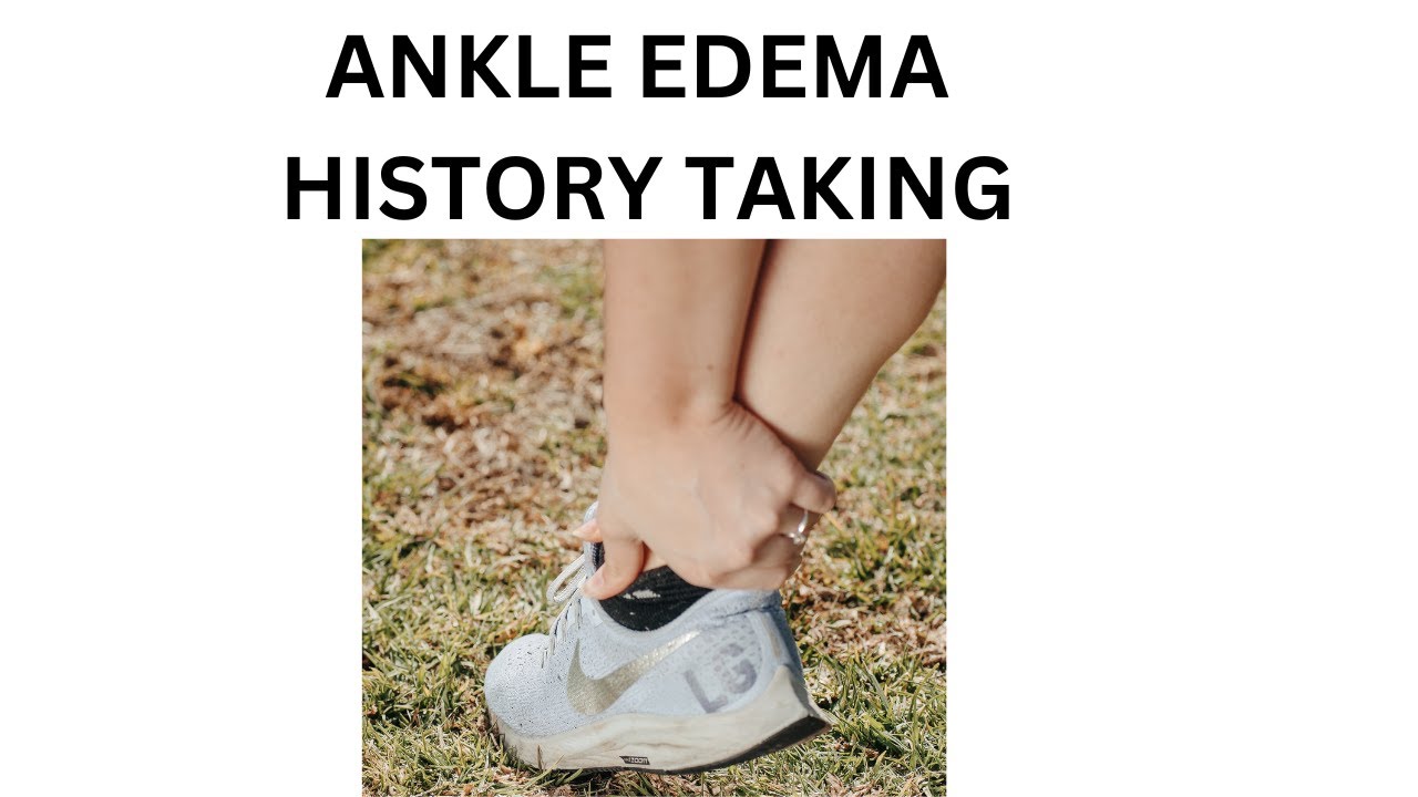 ANKLE EDEMA | HOW TO TAKE HISTORY FROM PATIENT WITH ANKLE EDEMA ? - YouTube